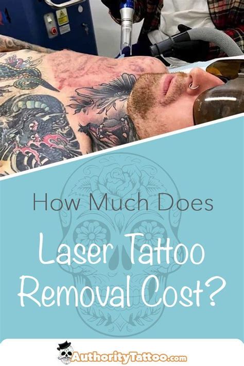 Tattoo Laser Removal Cost What To Expect Military And Veteran