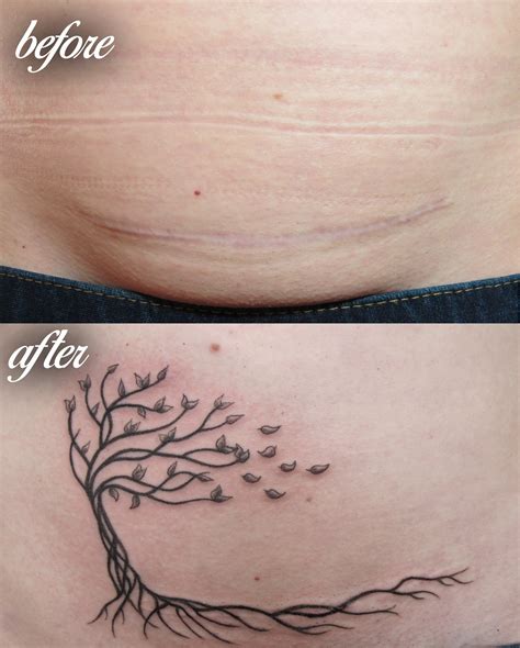 14 Beautiful C Section Scar Coverup Tattoos Numb Tattoo And Tummy Tucks