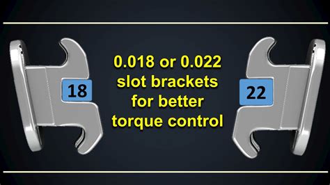 18 Versus Amp 22 Slot Ppt