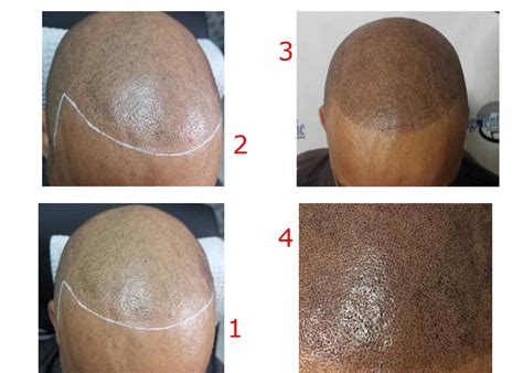 35 Hairline Tattoo Ideas Helpful Information You Need To Know