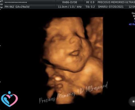 3D Pregnancy Ultrasounds Atascocita Tx 3D Pregnancy Ultrasounds Humble Tx