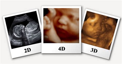 4D Pregnancy Scan Diagnostics Centre Habra Diagnostics Centre