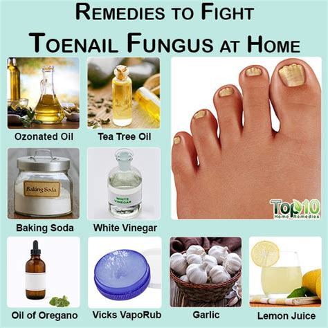 9 Natural Ways To Treat Toenail Fungus At Home Onychomycosis Help