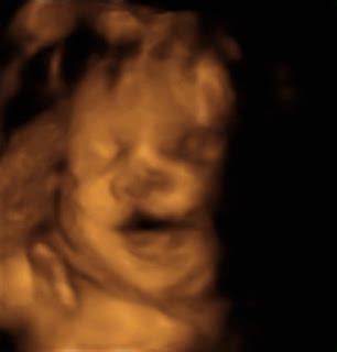 A Family In Progress 3D Sonogram Pics 31 Weeks Pregnant