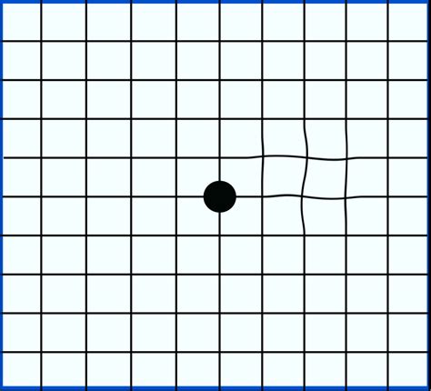 Amsler Grid Distortion