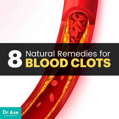 Blood Clots Causes Symptoms 8 Natural Remedies Dr Axe