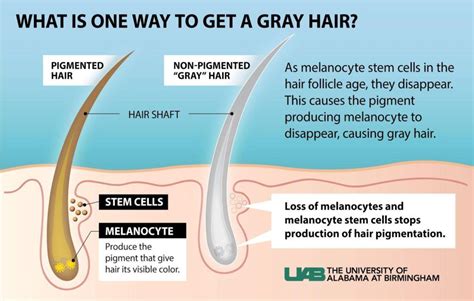 Causes And Solutions For Gray Hair Lifespan Io