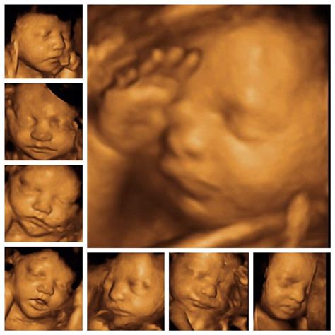 Cherished Memories 3D 4D Ultrasound 40 Photos Ultrasound Imaging