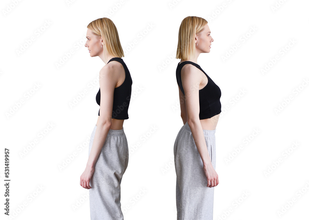 Comparison Of Bad And Good Posture Woman Slouching And Straightening