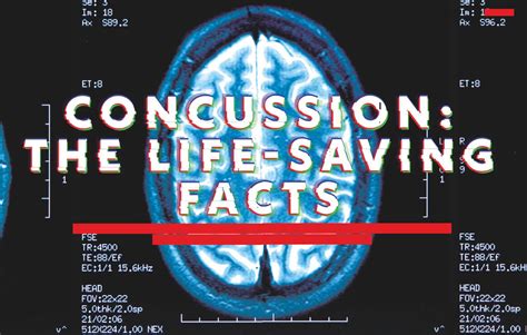 Concussion The Life Saving Facts