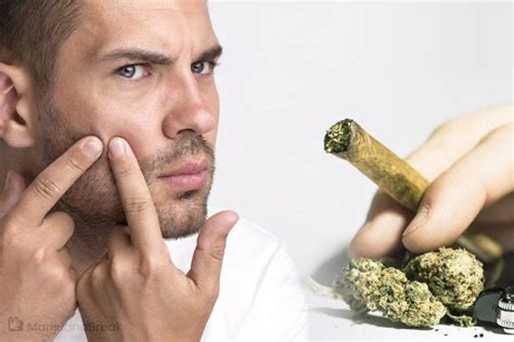 Does Smoking Weed Cause Acne Order Cannabis Meds