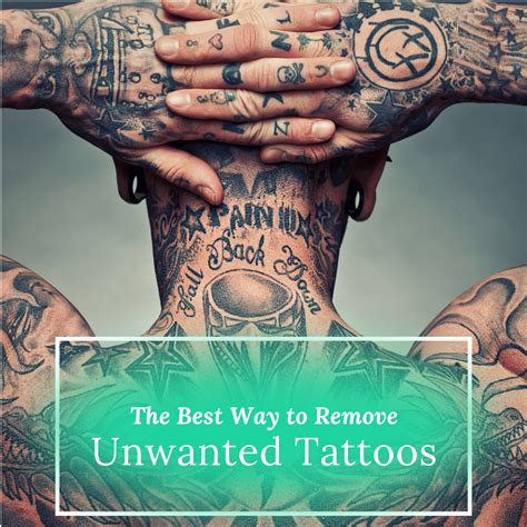 Experts Discuss Ways To Remove Unwanted Tattoos Cbs Pittsburgh