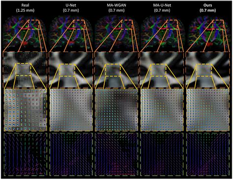 Frontiers Manifold Aware Synthesis Of High Resolution Diffusion From