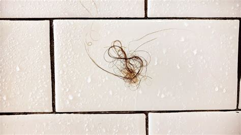 Hair Falling Out In The Shower Causes Symptoms Treatment