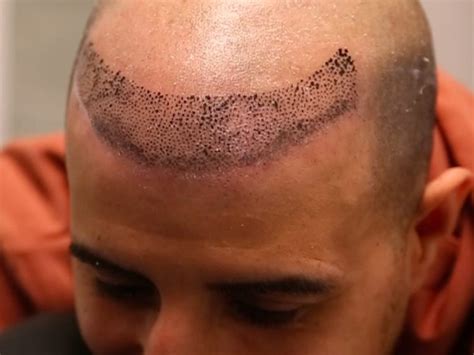 Hairline Tattoo Designs for a Natural Looking Hairline