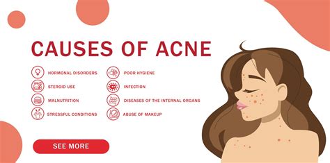 How To Balance Hormones Acne