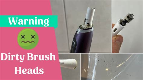 How To Clean Electric Toothbrush Mold