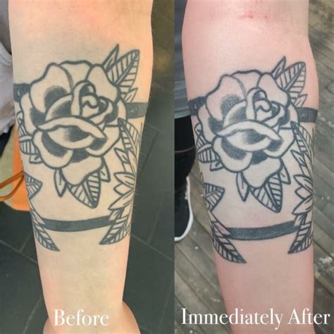 How To Fix Tattoo Blowout Or Still Healing Hero Tattoo