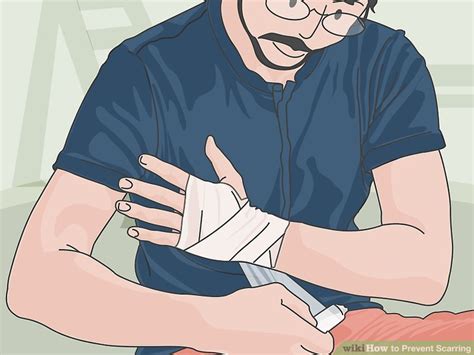 How To Prevent Scarring With Pictures Wikihow