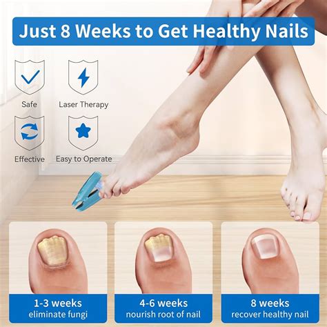 Laser Treatment For Toenail Fungus Everything You Should Know