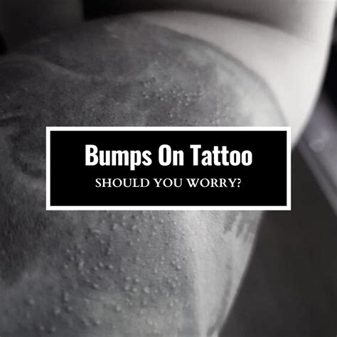 Little Bumps On Tattoo After Healed Should You Worry