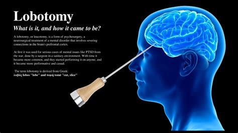 Lobotomy By Zozo C W On Prezi