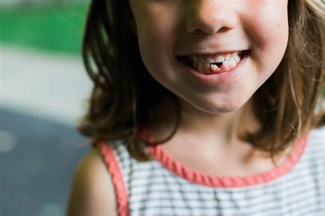 Losing Teeth Early And Puberty