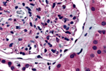 5 Ways Nephrin Antibodies Affect C3 Levels