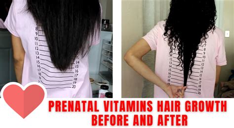 One Month Prenatal Vitamins For Hair Growth