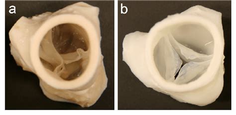 Pig Heart Valves Ingredients You Need to Know