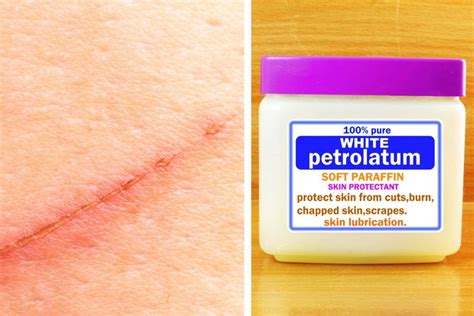 Prevent Scars The Secret Ingredient You Need For Scar Prevention