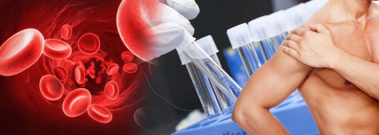 PRP Injection Cost: Treatment Prices and Packages Revealed