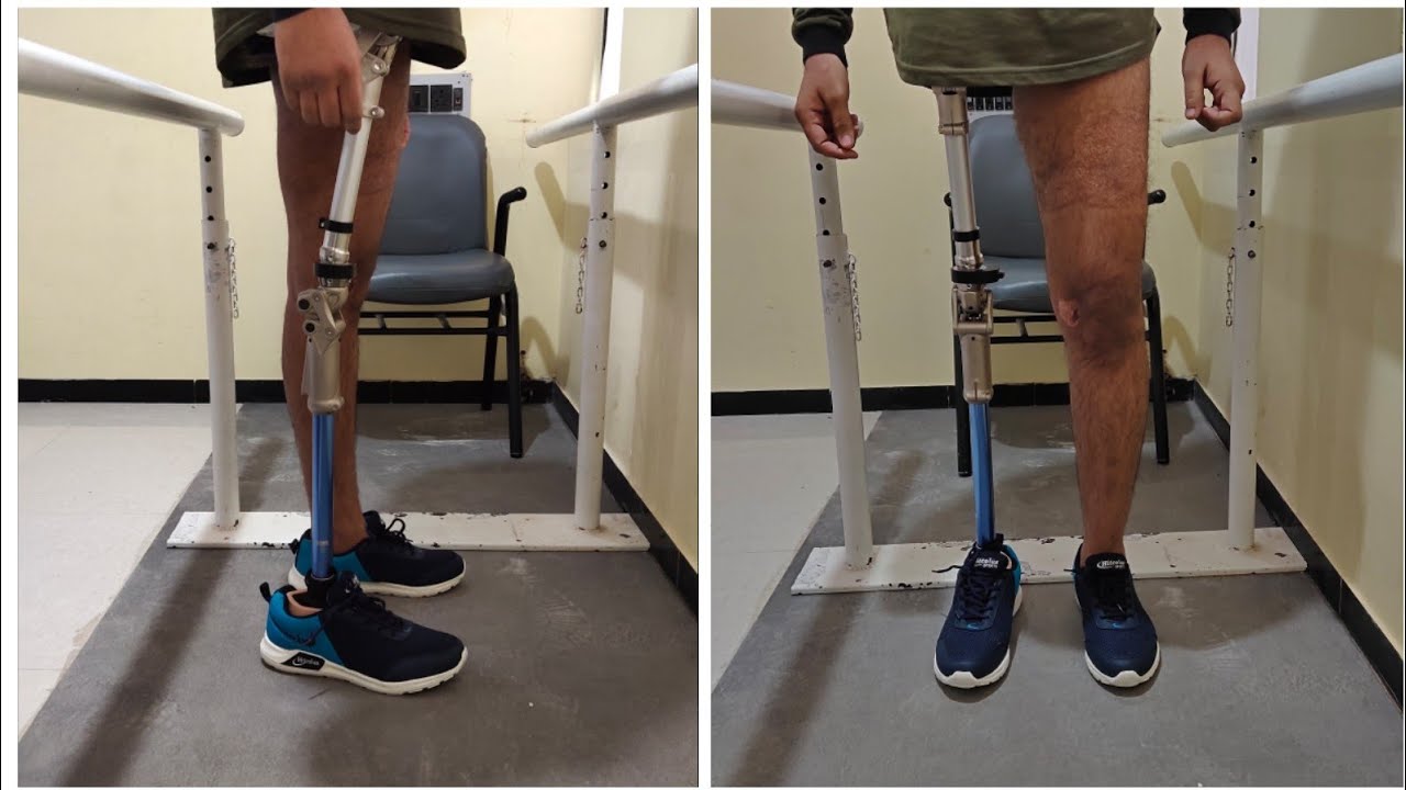 Radiographic Analysis Of Prosthetic Hip Youtube