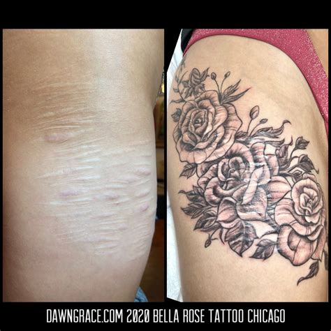 Scar Coverups Using Tattoos Hart Huntington Tattoo Co Orlando