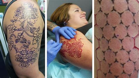 Scarification Tattoos Gone Wrong