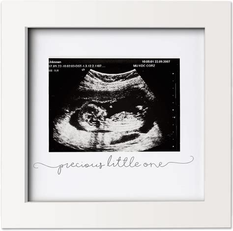 3D Sonogram Photo Capture Unforgettable Pregnancy Moments