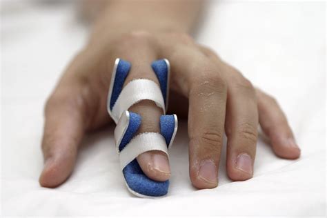 Finger Fracture Splint: Immobilize and Heal