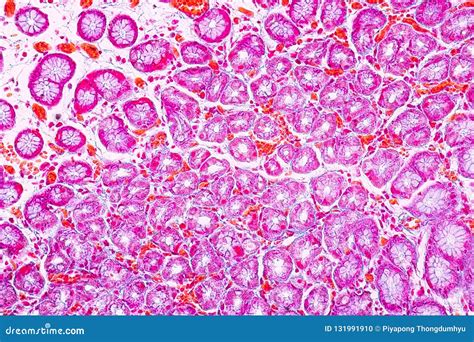 5 Ways Stomach Acid Appears Under Microscope