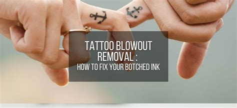 Tattoo Blowout Removal How To Fix Your Botched Ink