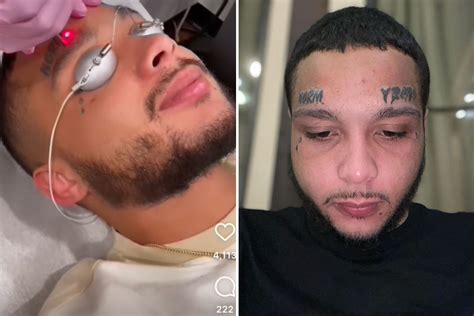 Teen Mom Star Bar Smith S Face Tattoo Meaning Revealed As He Lasers Off Ink To Move His Life In A Different Direction The Us Sun