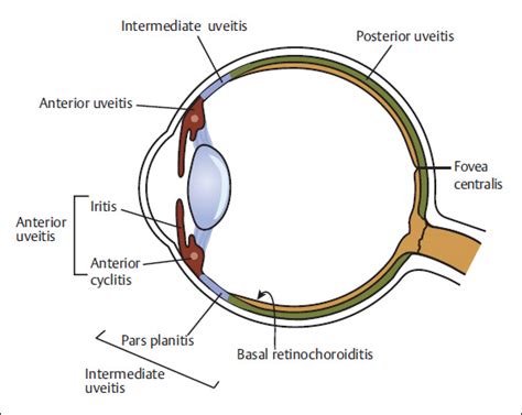 The Uveal Tract Ento Key