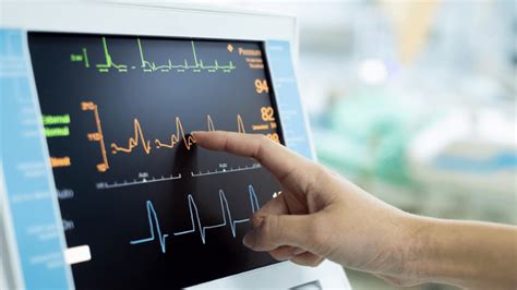 Top 10 Ekg Technician Certification Programs 2024