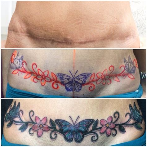 Hide Tummy Tuck Scars with Beautiful Tattoo Designs