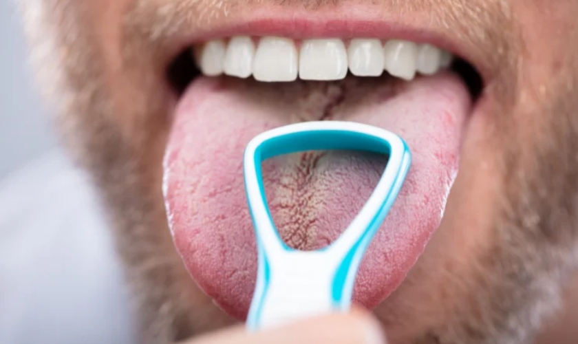 Understanding Tongue Dark Spots Causes Solutions Health Guide