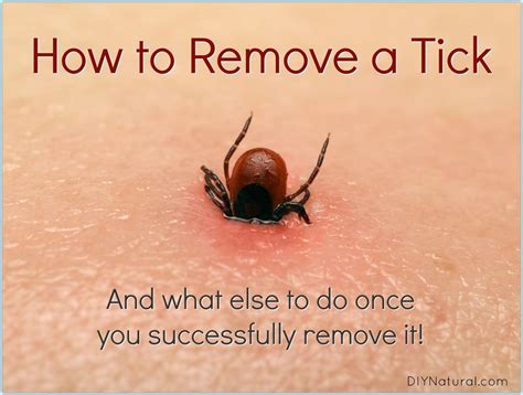 What Is The Best Tool To Remove Ticks At Michelle Farrell Blog