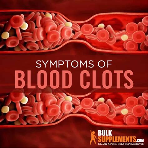 5 Reasons Sample Blood Clots