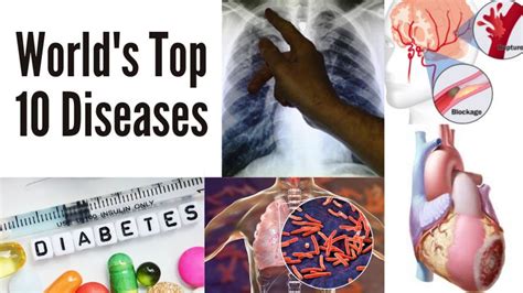 World Amp 39 S Top 10 Deadliest Diseases World Gulf News