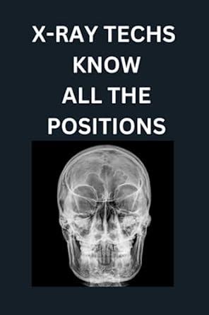 X Ray Techs Know All The Positions Simpson Lynn Amazon Com Books